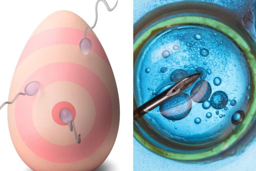 Fertility & IVF Support